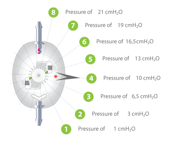 Programmable Shunt - Sphera Pro Hydrocephalus System - Image 7