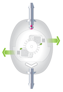 Programmable Shunt - Sphera Pro Hydrocephalus System - Image 4